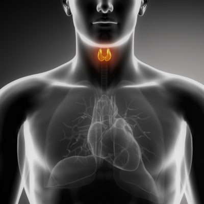 Hashimoto’s Thyroiditis