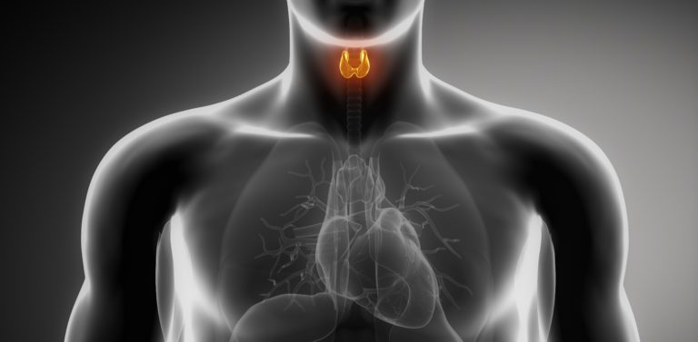 Hashimoto’s Thyroiditis